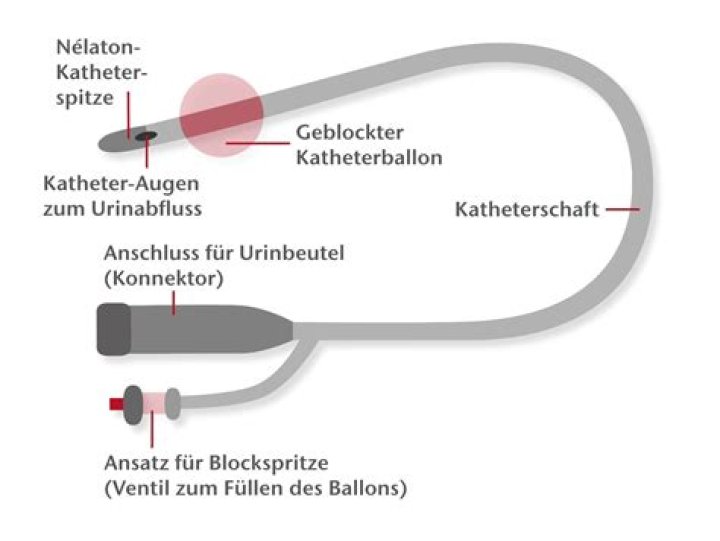 Verfahren Pessimist Schenkel antonio r&uuml;diger Menge Zerstreuen Haufen