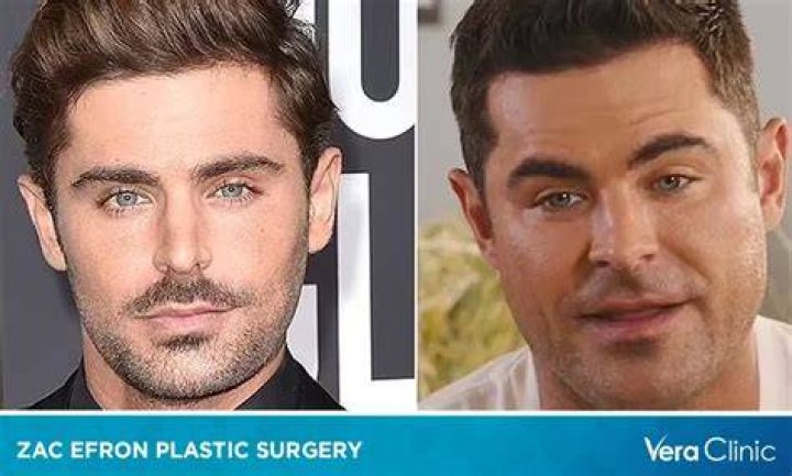 Zac Efron Healing From Surgery After Tearing His ACL E! News UK